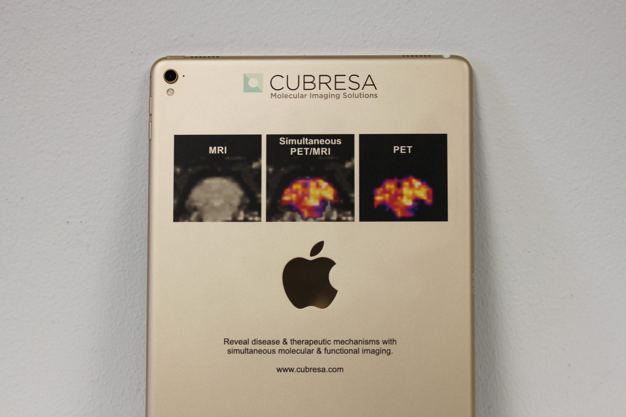 Color Printed iPad – MRI