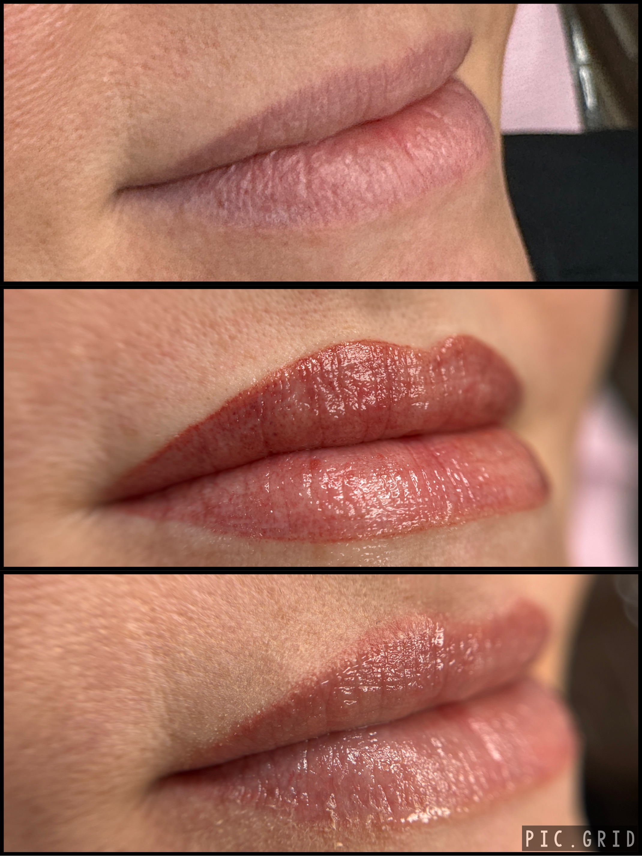 Lip blush treatment stages from top to bottom: before, right after, and healed