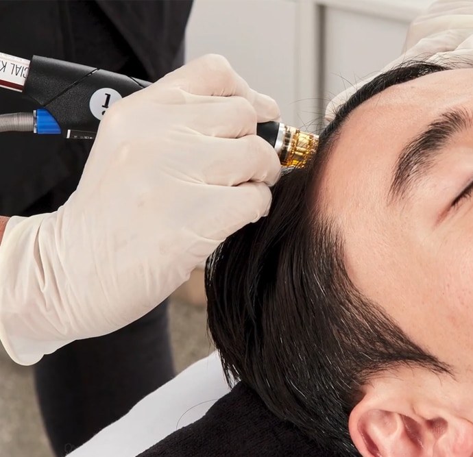 Scalp Health & Hair Loss: More Than Just a Trend