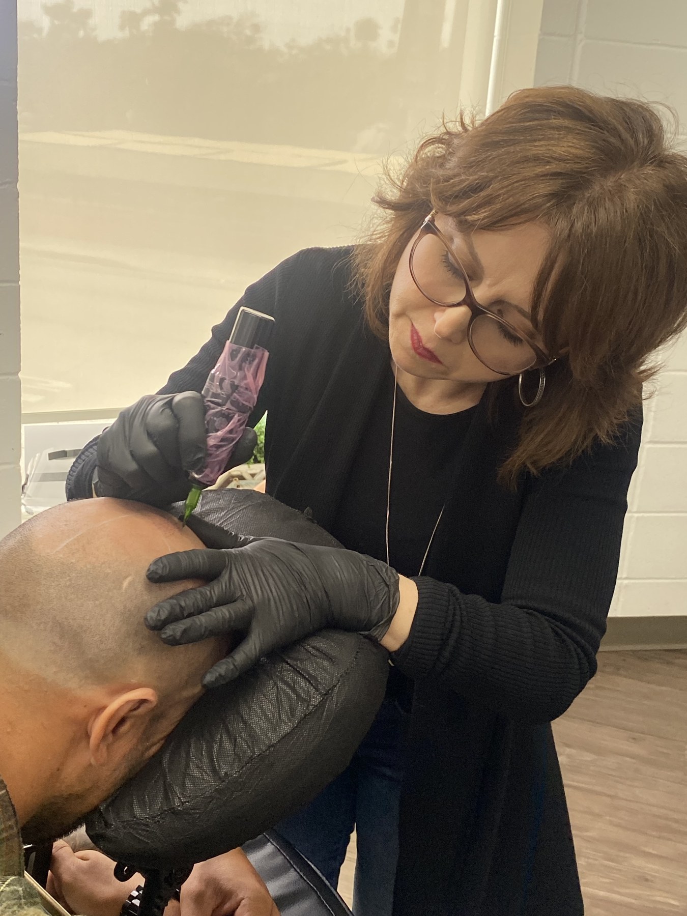 Scalp Micropigmentation