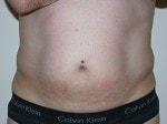 Body Procedures patient result