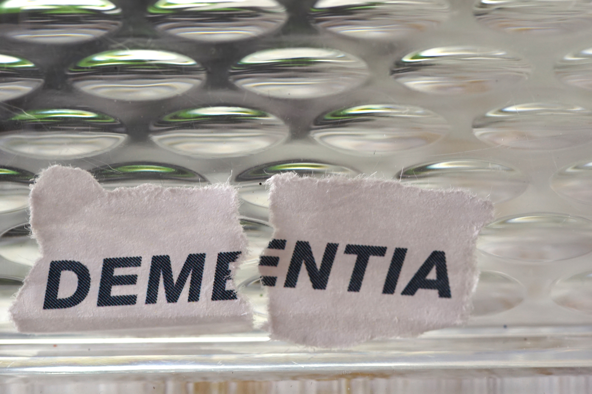 How Is Dementia Treated?