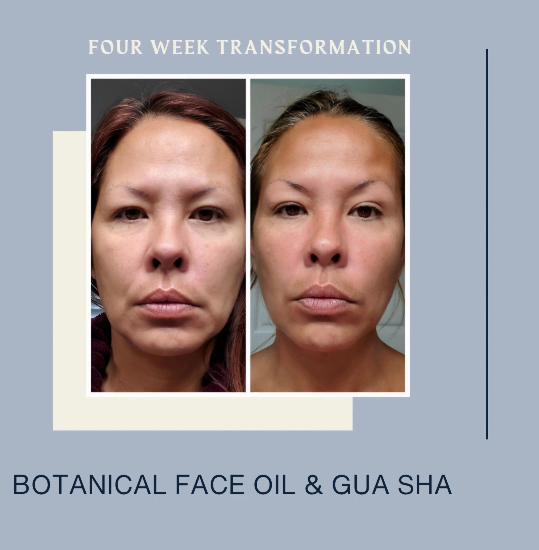 Calendula Face Oil For Mature Dry Skin Rosehip Jojoba Glow Serum Menopause Skin Care Natural Facial Moisturizer Spa Gift For Mom Birthday, product view 15