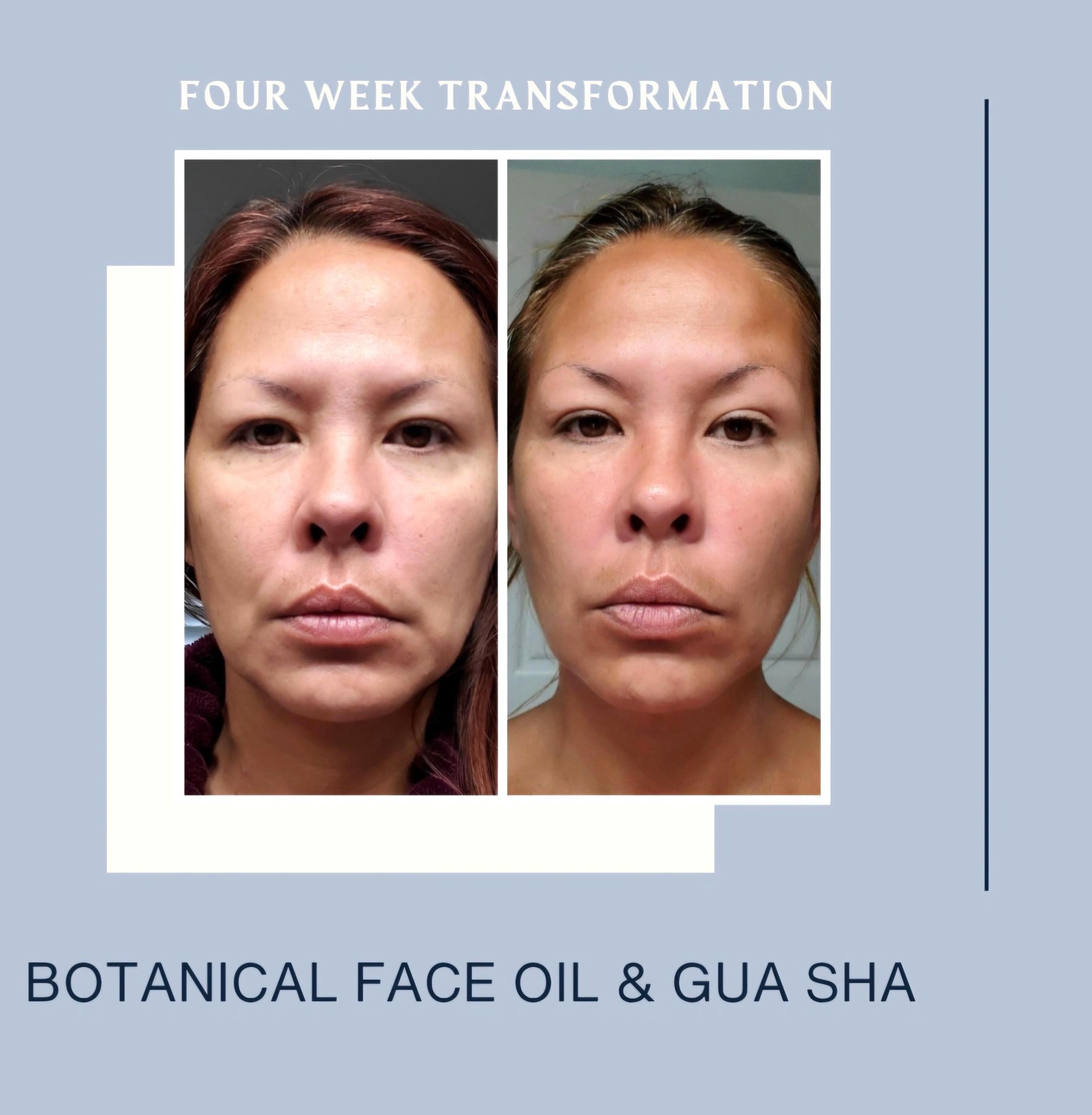 Natural Face Oil For Dry Sensitive Skin Calendula Infused Facial Serum With Jojoba Rosehip Glow Moisturizer Self Care Gift For Mom, product view 6