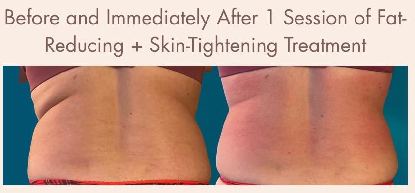 Before-and-after skin support treatment result