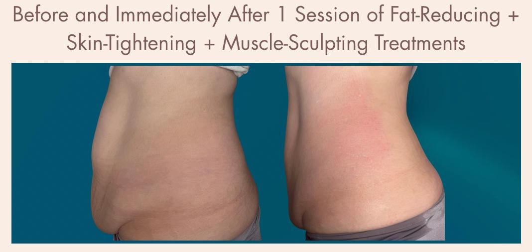 Before-and-after treatment result 1