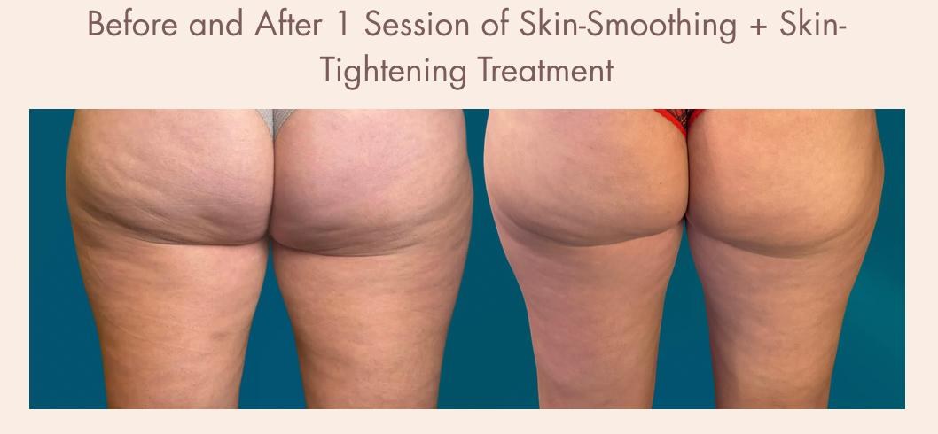 Before-and-after treatment result 2