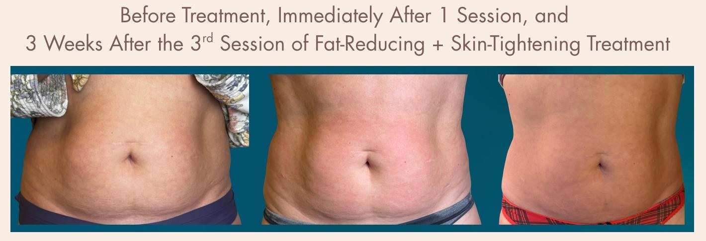 Before-and-after treatment result 3