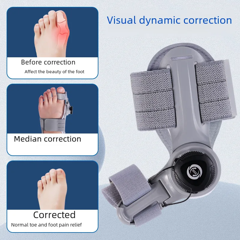 Upgraded Adjustable Bunion Corrector view 3