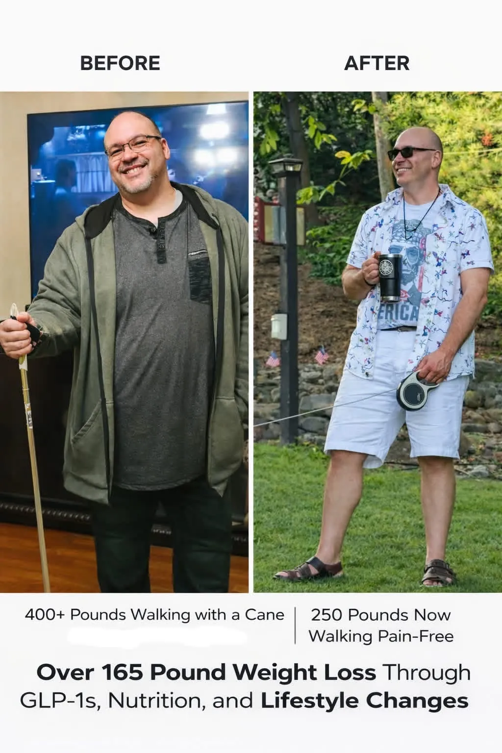 Before-and-after photos showing Anthony’s 165-pound weight-loss journey, from walking with a cane to walking pain-free