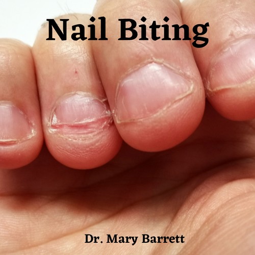 Stop Nail Biting
