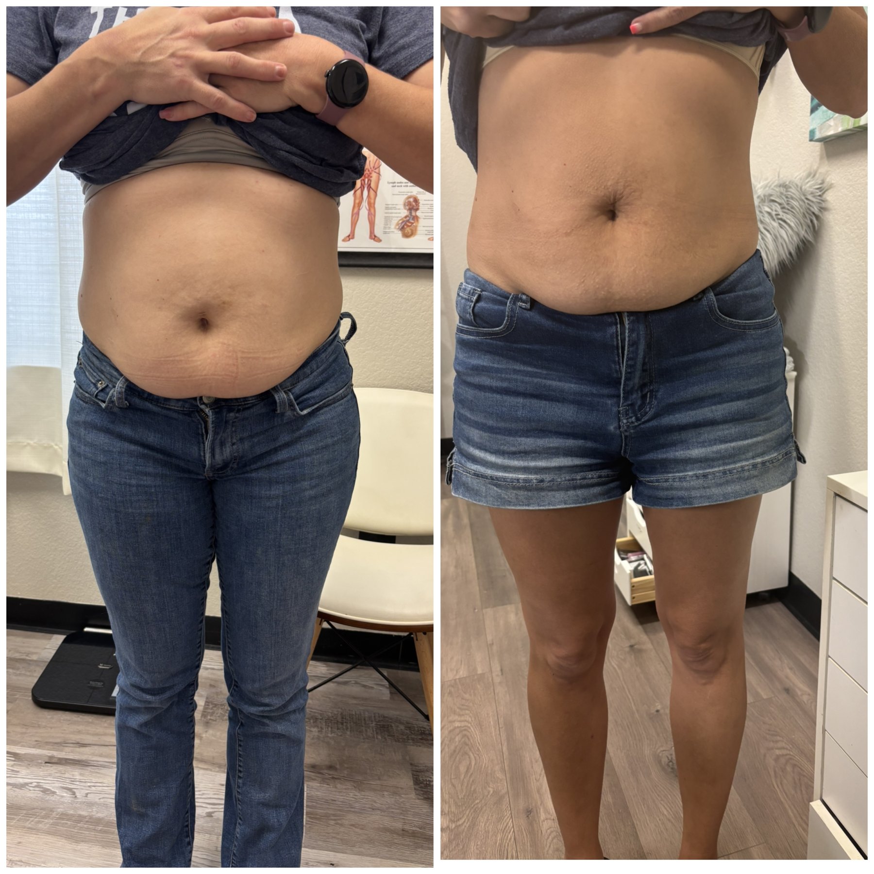Abdomen comparison photos supplied by the studio