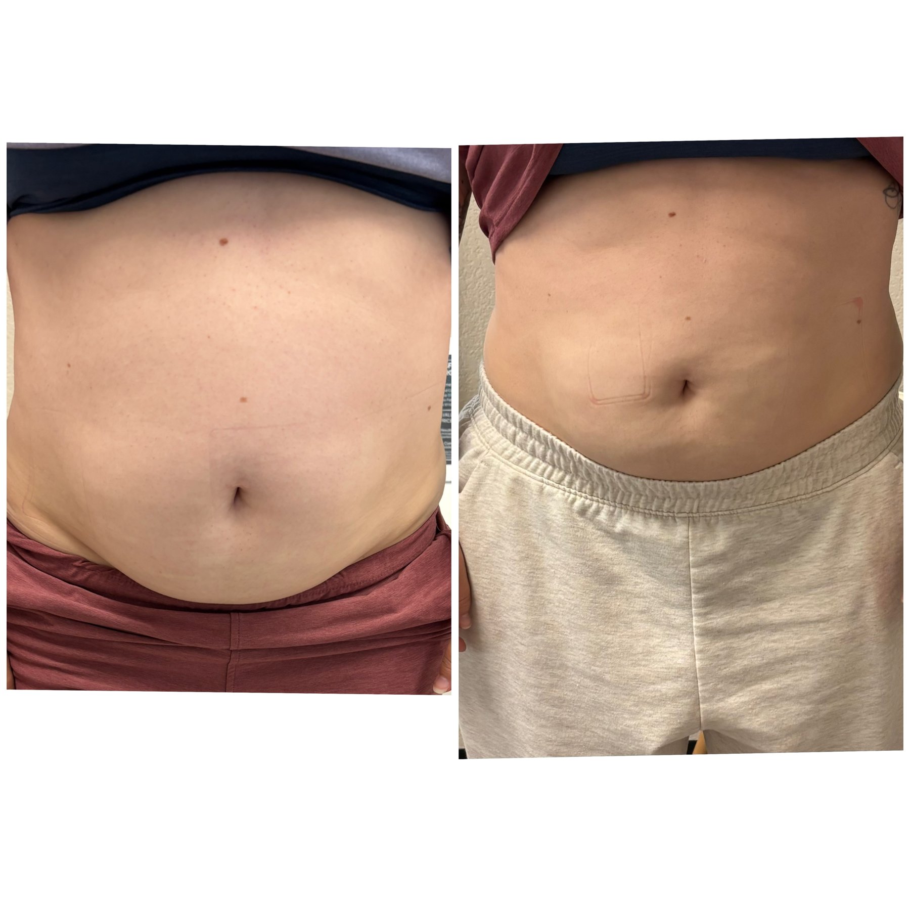 Close-up abdomen comparison collage