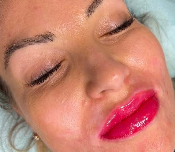 Vibrant lip blush treatment results