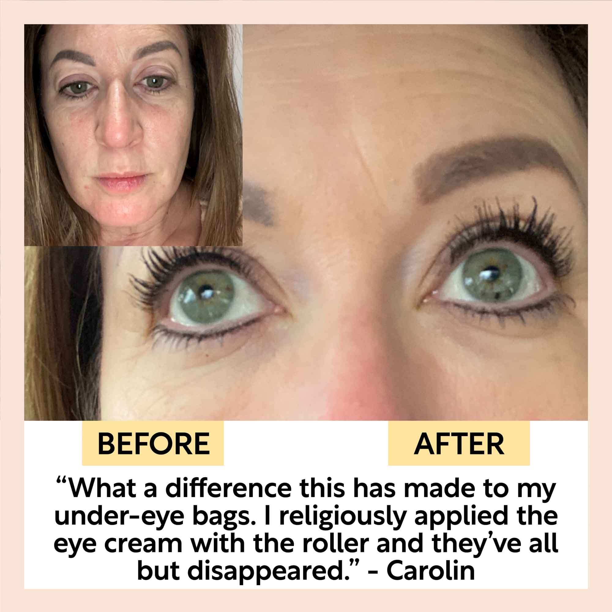 Eye Cream with Hyaluronic Acid & Coffee, view 8