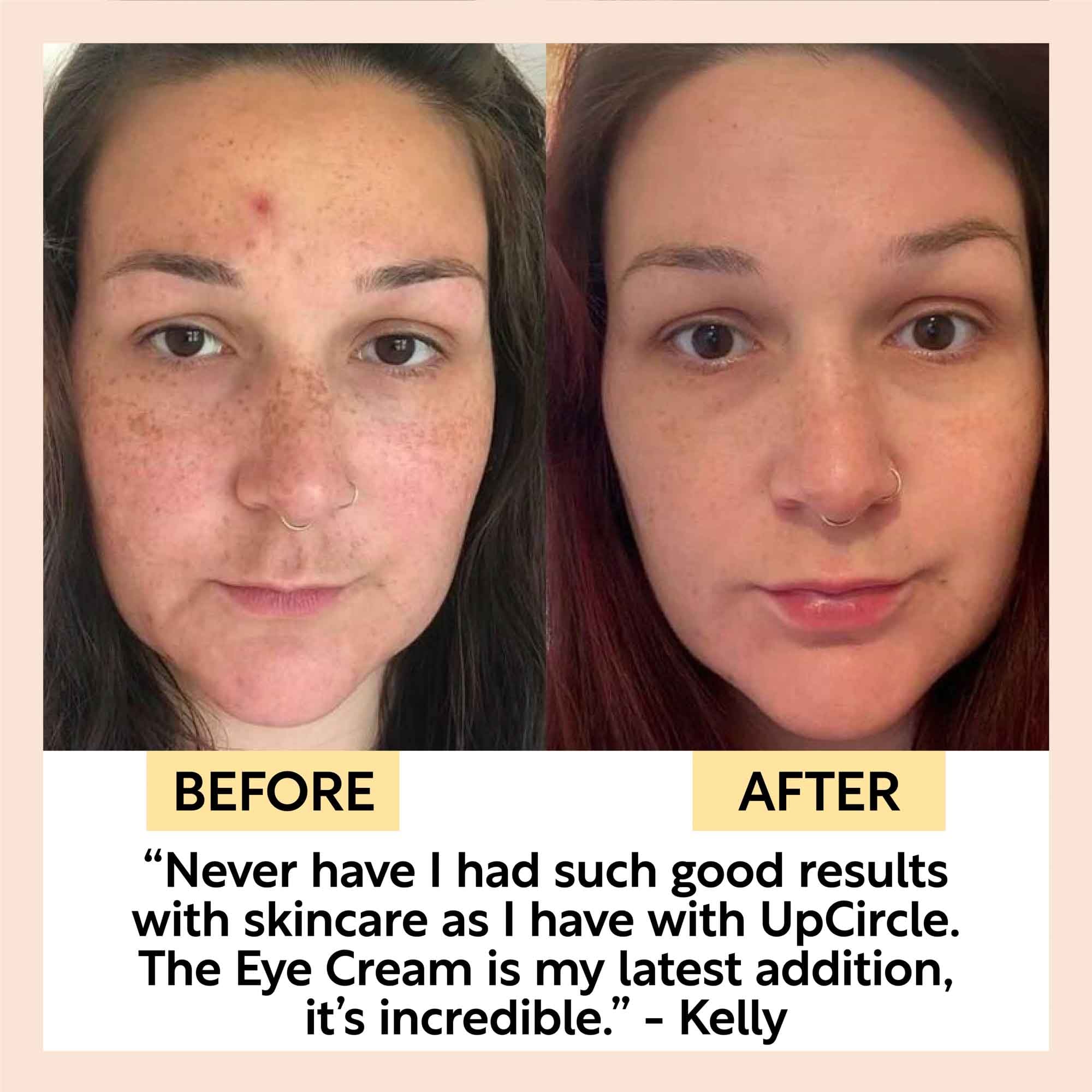 Eye Cream with Hyaluronic Acid & Coffee, view 9