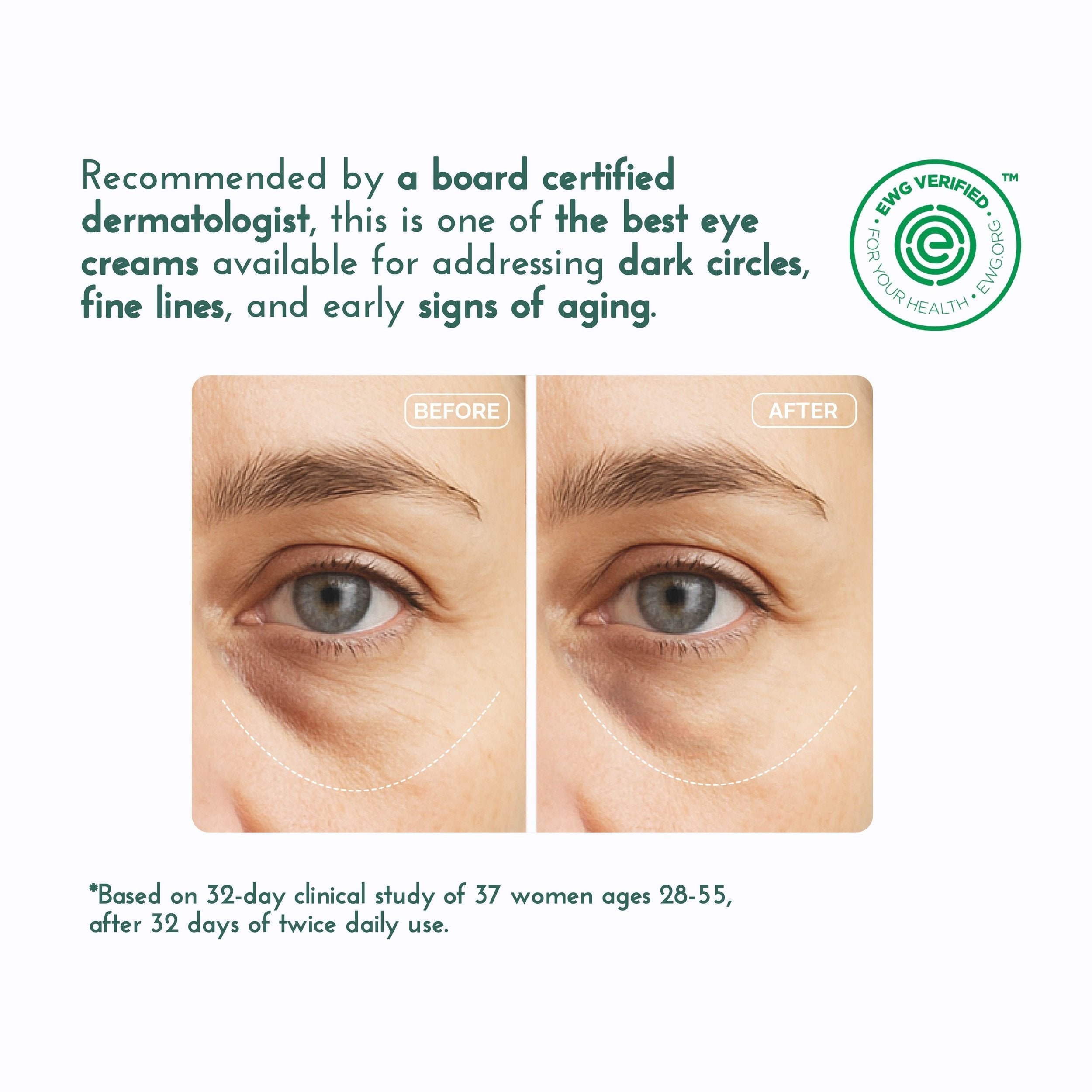 Eye & Neck Cream for Dark Circles and Wrinkles, view 3