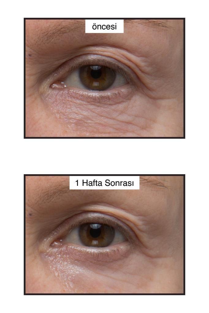 Murad Renewing Eye Cream 15ml - Anti-Aging Moisturizing Eye Cream for Fine Lines & Wrinkles, view 3