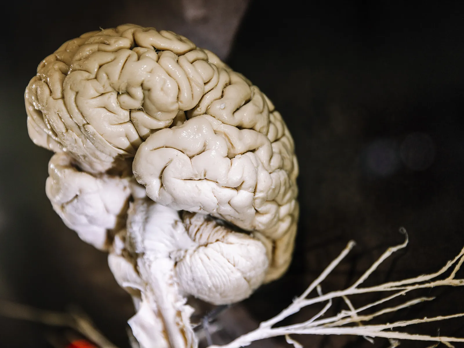 Anatomical human brain specimen
