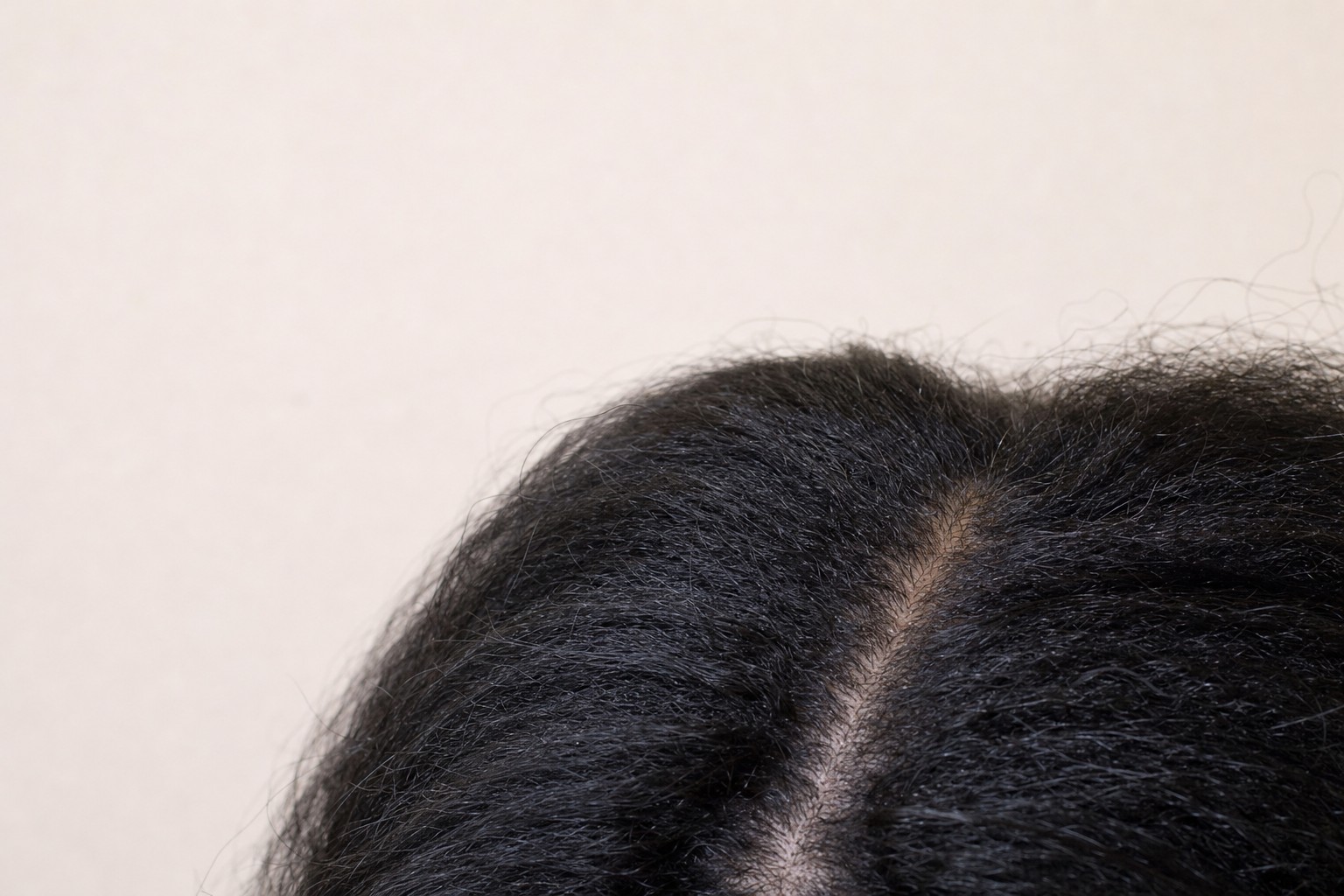 Short soft hairs growing along a clean hair part
